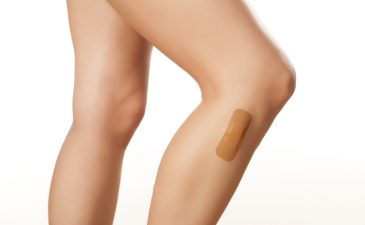 alergia nas pernas após depilação