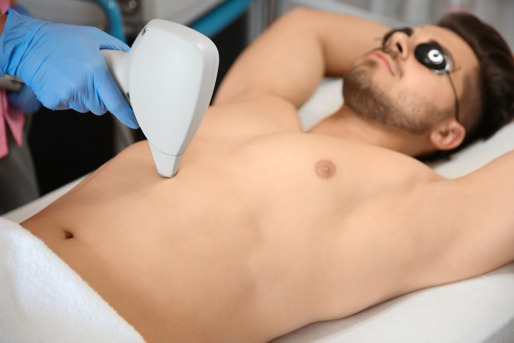 depilação a laser barriga masculina