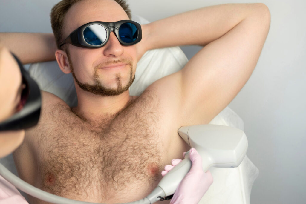 depilação a laser para homens