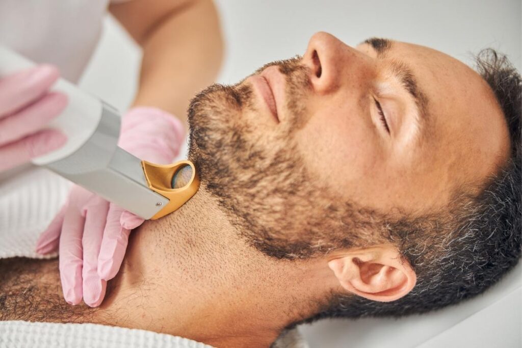 preço da depilação a laser masculina na barba